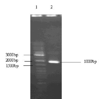 1% agarose gel electrophoresis. Lane 1, 100 bp DNA ladder marker. Lane ...