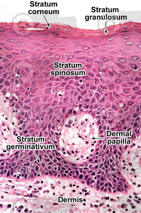 Dermal Papilla Histology