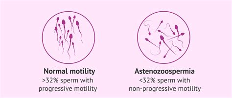 ICSI to treat asthenozoospermia or abnormal sperm motility