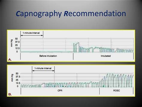 PPT - American Heart Association Guidelines for CPR 2015 PowerPoint ...