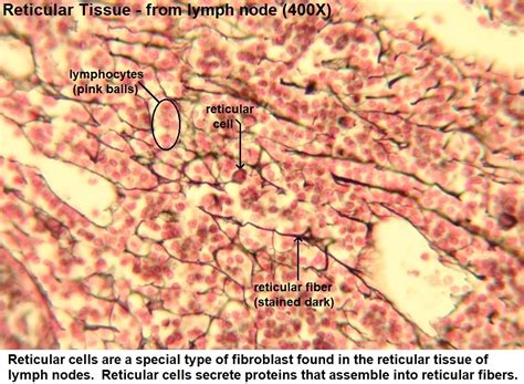 Reticular Connective Tissue Lymph Node