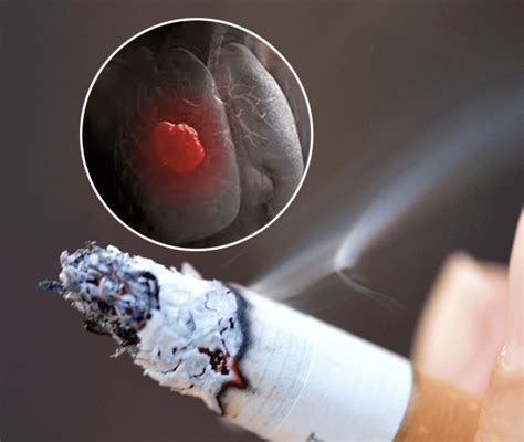 Unraveling science mystery of how smoking causes lung cancer: It's the ...