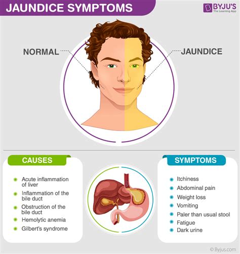 Describe Jaundice and What Causes It