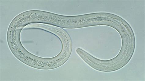 Hookworm Infections: Causes, Symptoms, and Treatments