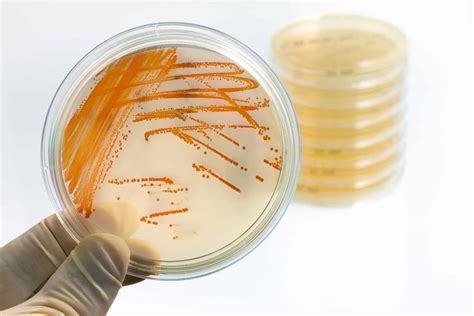 Different types of group B Strep tests - Group B Strep Support