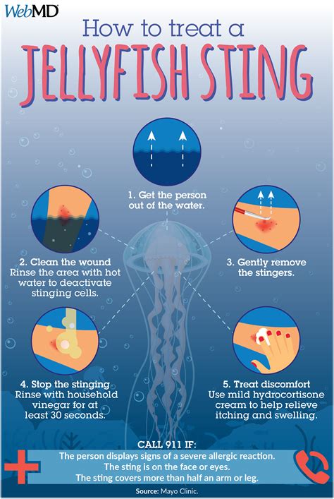 Jellyfish Stings Treatment | Jellyfish sting, Jellyfish, Jellyfish facts