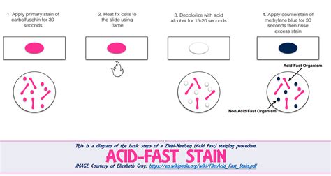 Ex 9 - Acid-Fast Stain - SCIENTIST CINDY