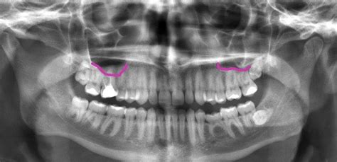 Pin en Dentistry