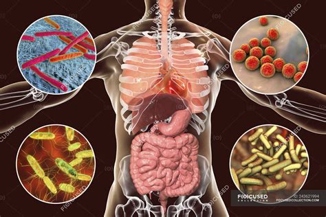 Digital illustration showing bacteria causing infections of respiratory ...