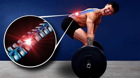 5 Reasons Why The Deadlift Hurts Your Back (Fix Your Form!)