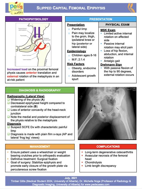 Slipped Capital Femoral Epiphysis | PedsCases