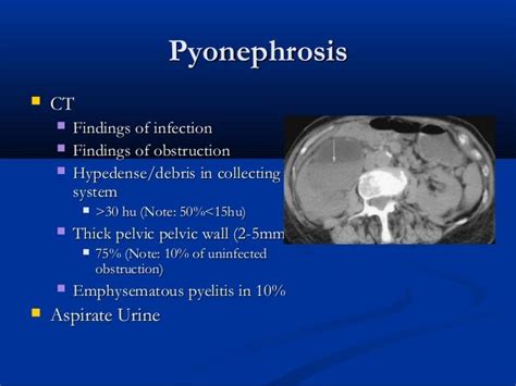 Renal inflammatory disease