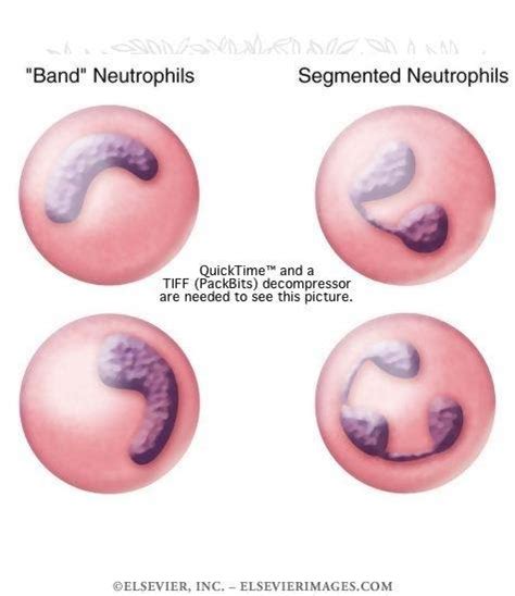 Band Neutrophils