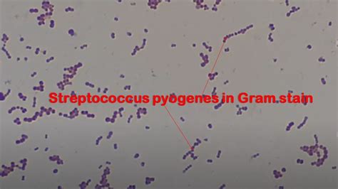 Streptococcus Pyogenes Gram Stain