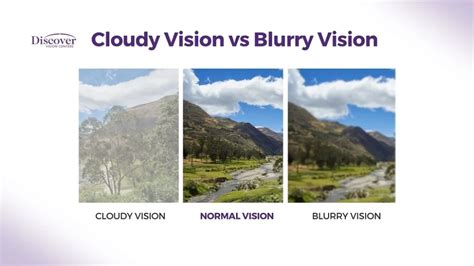 Cloudy Vision: Causes, Treatment & More | Discover Vision