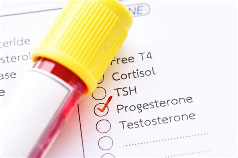 A Comprehensive Overview of the Follicle-Stimulating Hormone (FSH) Test ...