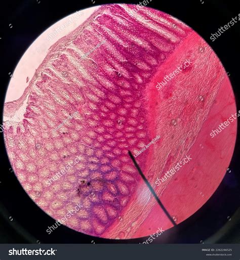 Large Intestine Simple Columnar Epithelium Low Stock Photo 2262246525 ...