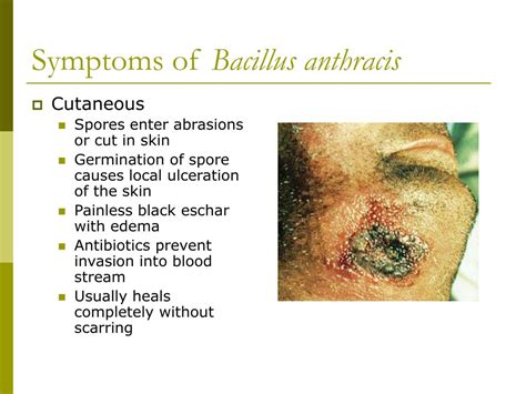 PPT - Mechanism of Bacterial Damage & Bacterial Toxins PowerPoint ...