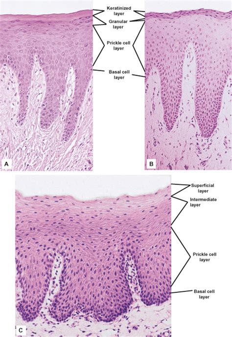 Stratified Squamous Keratinized Epithelium Labeled