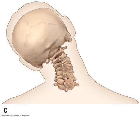 classification - If the human atlanto-axial joint is pivotal only, what ...