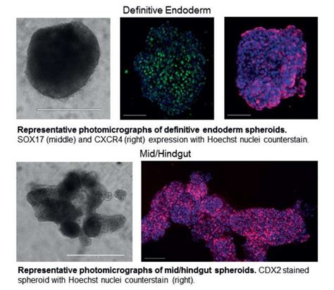 3D Organoid Cell Culture - Optimising disease models for research and ...