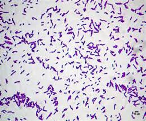 Bacillus Cereus Simple Stain