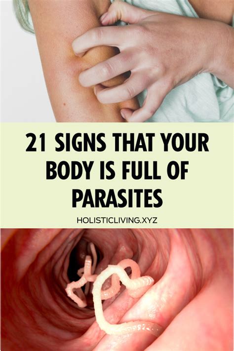 symptoms of parasites in body – Libracha