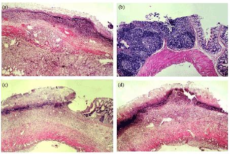 Lactobacillus Casei Gram Stain