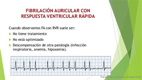 Fibrilacion auricular