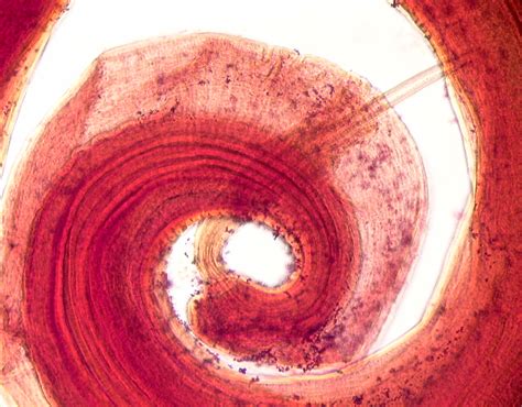 Trichuris trichiura | Medical Laboratories