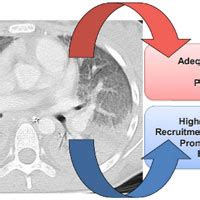 Adjunct and Rescue Therapies for Refractory Hypoxemia – Critical Care ...