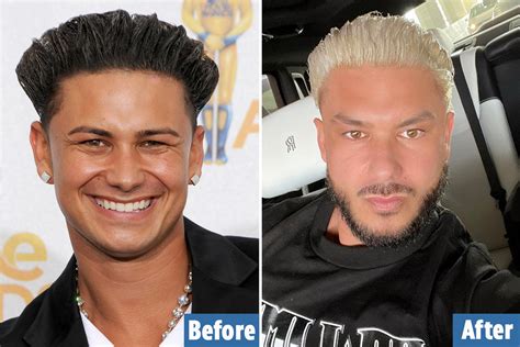 Jersey Shore's Pauly D may have gotten an eye lift and fillers as fans ...