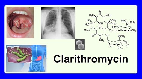 clarithromycin - YouTube