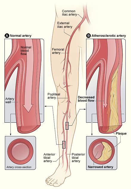 Vascular & Endovascular Surgery - Angiography