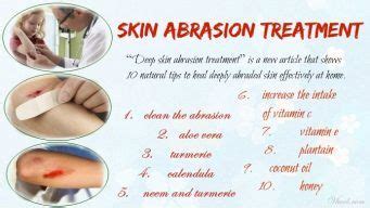 10 Natural Tips Of Deep Skin Abrasion Treatment