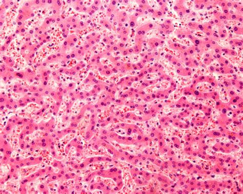 190+ Hepatocyte Histology Stock Photos, Pictures & Royalty-Free Images ...