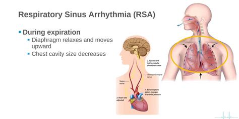 ¿Qué es la arritmia sinusal? ¿Es una amenaza para la vida? – Bienvenida