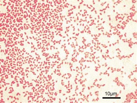 Biologi: Pewarnaan gram pada bakteri