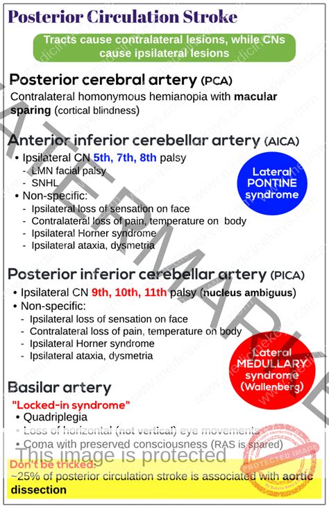 Posterior circulation stroke - Medicine Keys for MRCPs