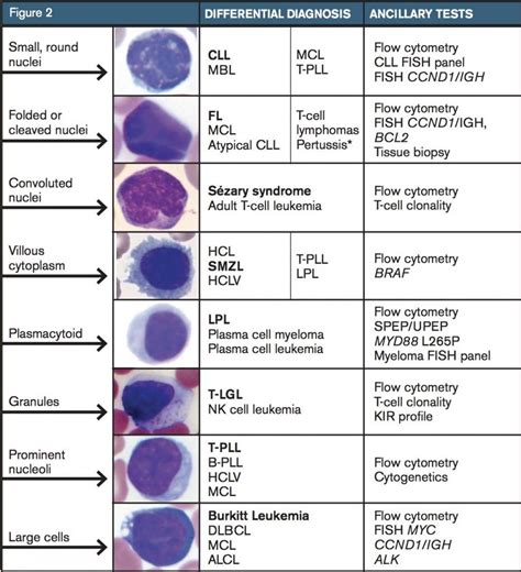 Approach to Lymphocytosis - Ask Hematologist | Understand Hematology ...