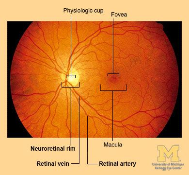 Retina & Optic Nerve Through Ophthalmoscope : Anatomy : The Eyes Have It