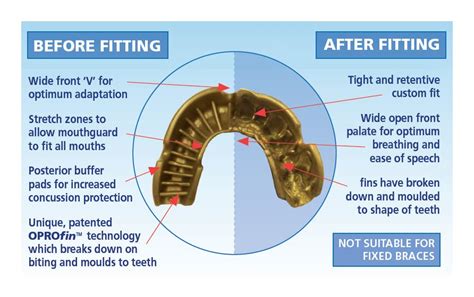 OPRO Flag Mouthguard :: Sports Supports | Mobility | Healthcare Products