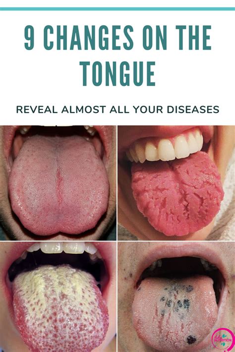 BE AWARE OF THIS: THESE 9 CHANGES ON THE TONGUE REVEAL ALMOST ALL YOUR ...