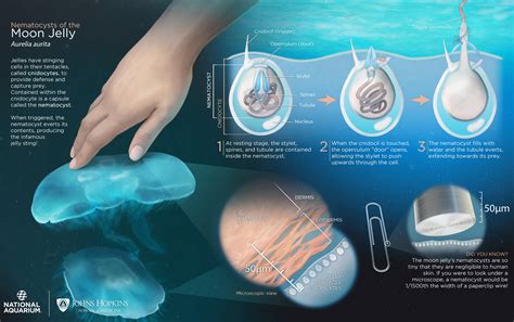 Jellyfish Sting - Symptoms, How To Treat A Jellyfish Sting