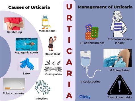 Urticarias Physical Causes Symptoms Treatment