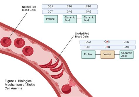 Sickle Cell Anemia: How A Spelling Error Can Cause Disease – NC DNA Day ...