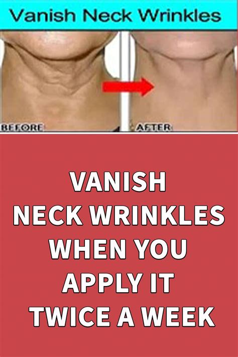 VANISH NECK WRINKLES WHEN YOU APPLY IT TWICE A WEEK | Neck wrinkles ...