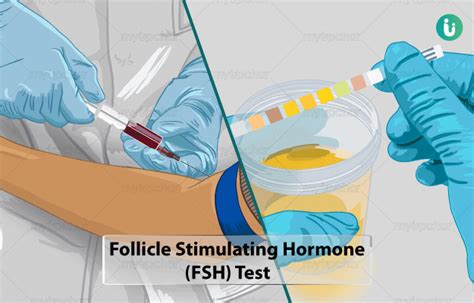 FSH (Follicle Stimulating Hormone) Test: Procedure, Purpose, Results ...