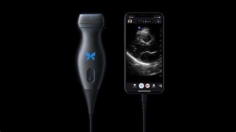 Butterfly rescinds features from handheld ultrasound device, working ...