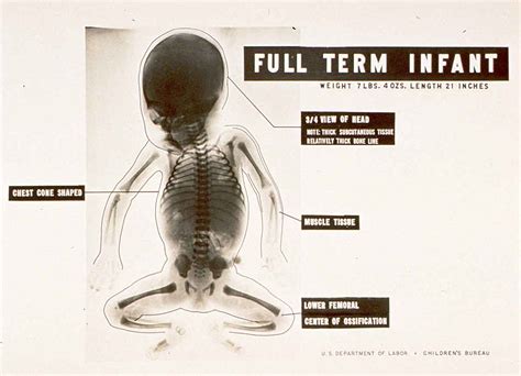 Dream Anatomy: Gallery: Infant Growth and Development X-ray